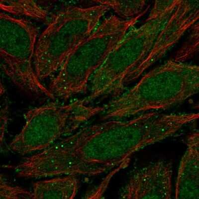 Immunocytochemistry/ Immunofluorescence: ZNF510 Antibody [NBP2-13578]