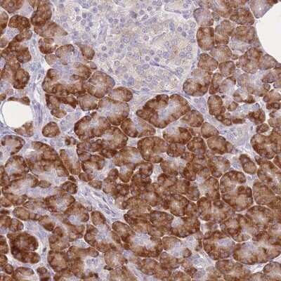 Immunohistochemistry-Paraffin: ZNF510 Antibody [NBP2-13578]