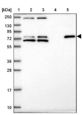 Western Blot: ZNF510 Antibody [NBP2-13578]