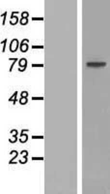 Western Blot: ZNF510 Overexpression Lysate [NBP2-07250]