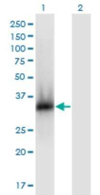 Western Blot: ZNF511 Antibody (3G1) [H00118472-M06]