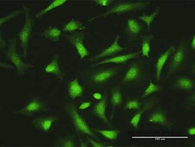 Immunocytochemistry/ Immunofluorescence: ZNF511 Antibody [H00118472-D01P]