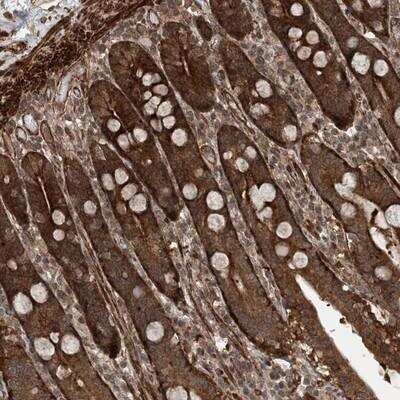 Immunohistochemistry-Paraffin: ZNF511 Antibody [NBP1-81131]