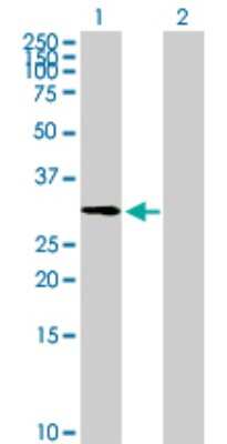 Western Blot: ZNF511 Antibody [H00118472-B01P]