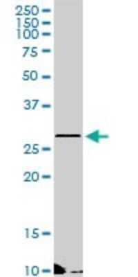 Western Blot: ZNF511 Antibody [H00118472-D01P]