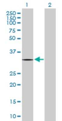 Western Blot: ZNF511 Antibody [H00118472-D01P]