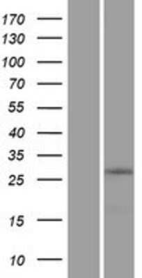 Western Blot: ZNF511 Overexpression Lysate [NBP2-05462]