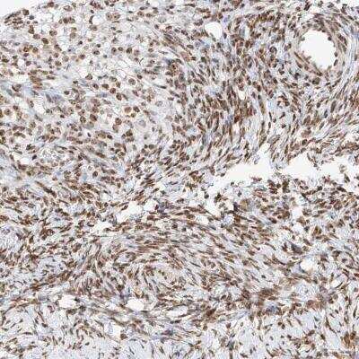 Immunohistochemistry-Paraffin: ZNF512 Antibody [NBP1-81371]
