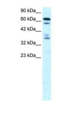 Western Blot: ZNF512 Antibody [NBP1-79967]