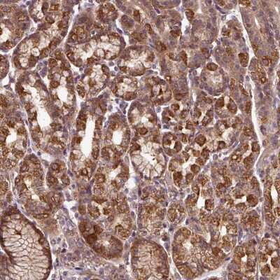 Immunohistochemistry: ZNF513 Antibody [NBP2-49009]