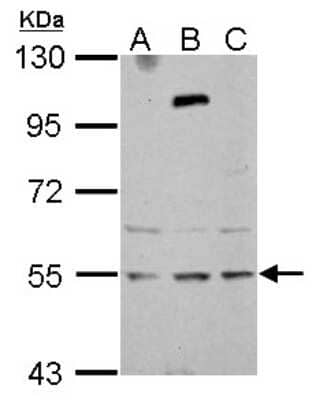 Western Blot: ZNF513 Antibody [NBP2-15175]