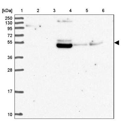 Western Blot: ZNF513 Antibody [NBP2-49009]