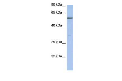 Western Blot: ZNF513 Antibody [NBP2-86508]