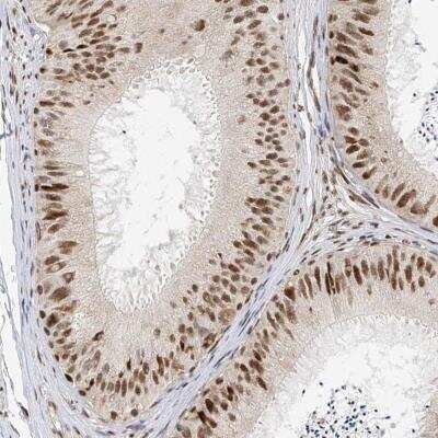 Immunohistochemistry: ZNF514 Antibody [NBP1-82232]