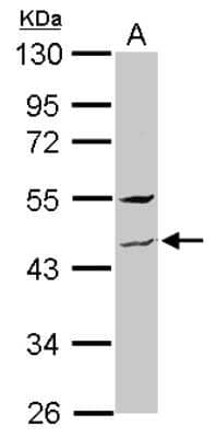 Western Blot: ZNF514 Antibody [NBP2-21022]