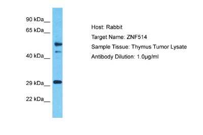 Western Blot: ZNF514 Antibody [NBP2-88700]