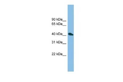 Western Blot: ZNF514 Antibody [NBP2-88701]