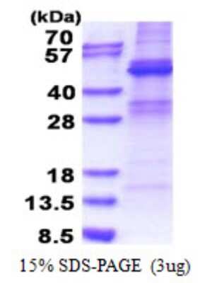 SDS-PAGE: Recombinant Human ZNF514 His Protein [NBP2-22957]