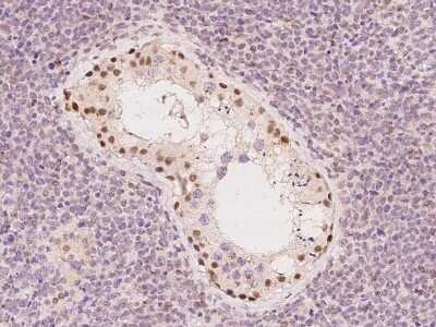 Immunohistochemistry-Paraffin: ZNF516 Antibody [NBP2-98464]