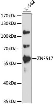 Western Blot: ZNF517 AntibodyAzide and BSA Free [NBP2-94510]