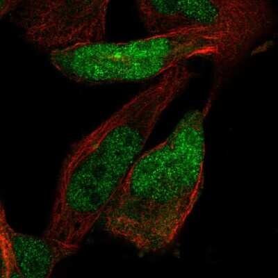 Immunocytochemistry/ Immunofluorescence: ZNF518 Antibody [NBP2-58184]