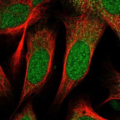 Immunocytochemistry/ Immunofluorescence: ZNF518B Antibody [NBP1-81380]