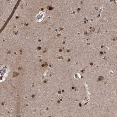 Immunohistochemistry: ZNF518B Antibody [NBP1-81379]