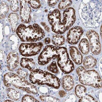 Immunohistochemistry-Paraffin: ZNF519 Antibody [NBP1-81953]