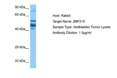 Western Blot: ZNF519 Antibody [NBP2-83863]