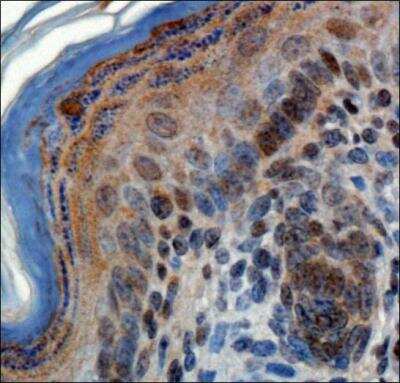 Immunohistochemistry: ZNF521 Antibody - BSA Free [NBP1-91270]