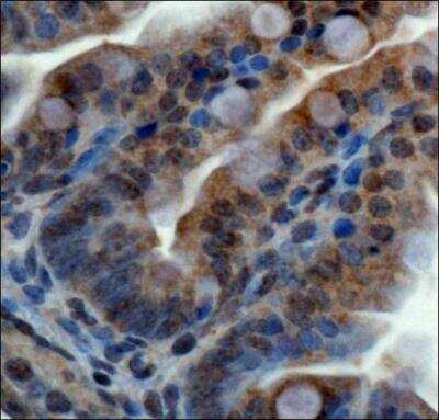 Immunohistochemistry: ZNF521 Antibody - BSA Free [NBP1-91271]