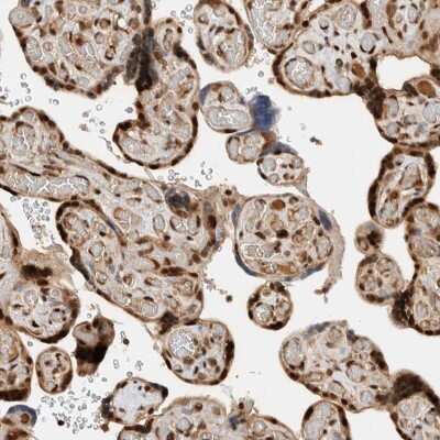Immunohistochemistry-Paraffin: ZNF521 Antibody [NBP1-84882]
