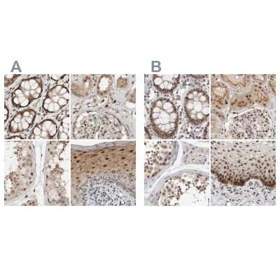 Immunohistochemistry-Paraffin: ZNF521 Antibody [NBP1-84882]