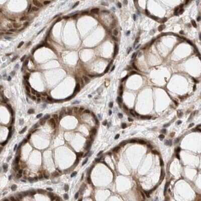 Immunohistochemistry-Paraffin: ZNF521 Antibody [NBP1-84882]