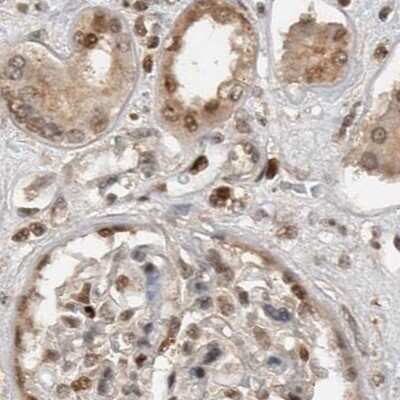 Immunohistochemistry-Paraffin: ZNF521 Antibody [NBP1-84882]