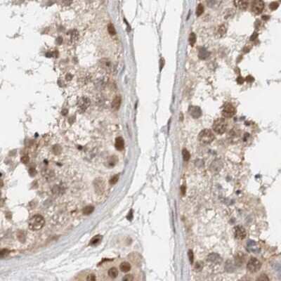 Immunohistochemistry-Paraffin: ZNF521 Antibody [NBP1-84882]