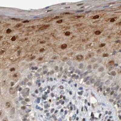 Immunohistochemistry-Paraffin: ZNF521 Antibody [NBP1-84882]