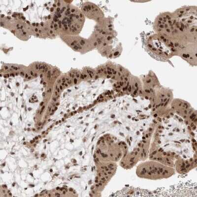 Immunohistochemistry-Paraffin: ZNF521 Antibody [NBP1-84883]