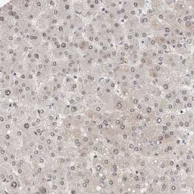 Immunohistochemistry-Paraffin: ZNF521 Antibody [NBP1-84883]