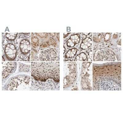 Immunohistochemistry-Paraffin: ZNF521 Antibody [NBP1-84883]