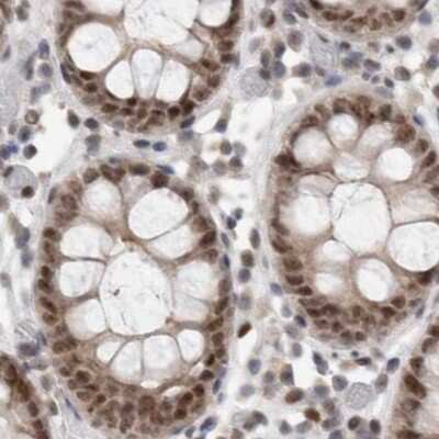 Immunohistochemistry-Paraffin: ZNF521 Antibody [NBP1-84883]