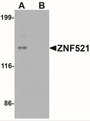 Western Blot: ZNF521 AntibodyBSA Free [NBP2-41174]