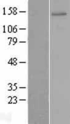 Western Blot: ZNF521 Overexpression Lysate [NBL1-18170]