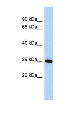 Western Blot: ZNF524 Antibody [NBP1-80423]