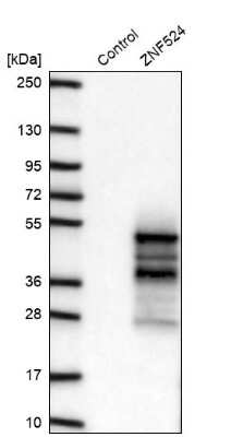 Western Blot: ZNF524 Antibody [NBP2-13579]