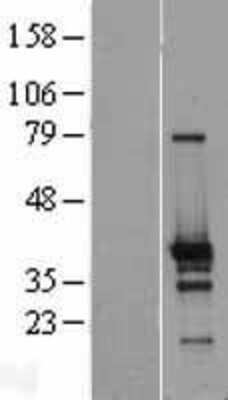 Western Blot: ZNF524 Overexpression Lysate [NBL1-18171]