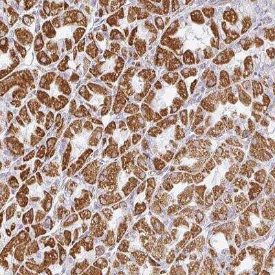 Immunohistochemistry-Paraffin: ZNF526 Antibody [NBP2-31644]