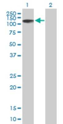 Western Blot: ZNF526 Antibody [H00116115-B01P]