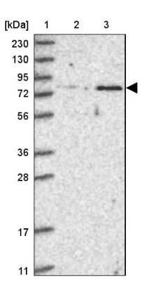 Western Blot: ZNF526 Antibody [NBP2-32007]