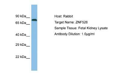 Western Blot: ZNF526 Antibody [NBP2-88705]